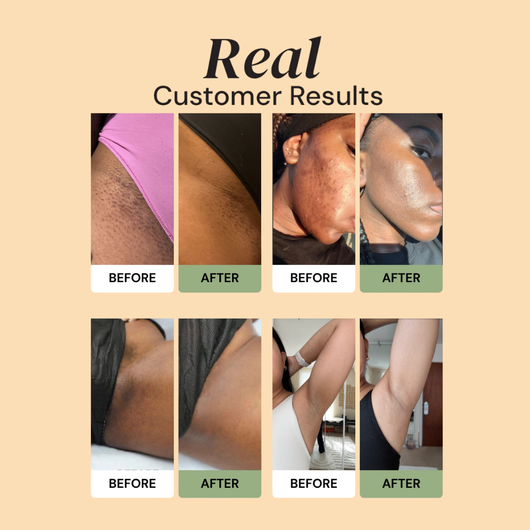 Resultat efter användning